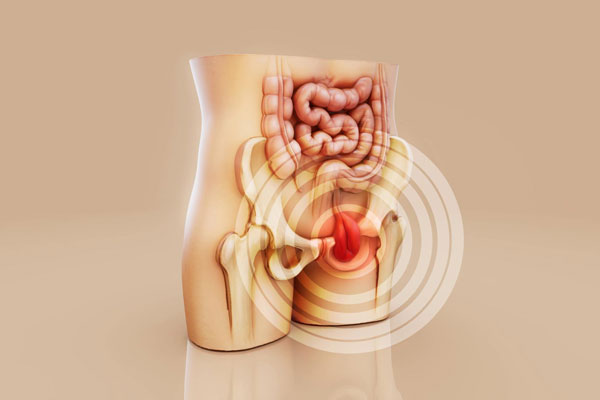 Hernia inguinal: síntomas, riesgos y cuándo acudir con un cirujano