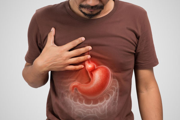 Reflujo gastroesofágico y hernia hiatal: cuándo acudir a valoración médica